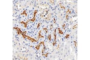 Immunohistochemistry (Paraffin-embedded Sections) (IHC (p)) image for anti-Solute Carrier Family 6 (Neutral Amino Acid Transporter), Member 19 (SLC6A19) antibody (ABIN7075682)