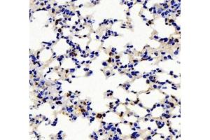 Immunohistochemistry of paraffin embedded mouse pneumonia using IL-2 Receptor alpha (ABIN7074349) at dilution of 1: 500 (400x lens) (CD25 抗体)