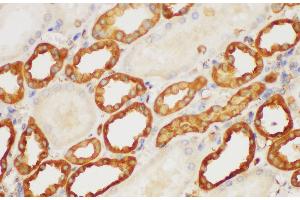 Immunohistochemistry of paraffin-embedded Human kidney using S100A6 Polycloanl Antibody at dilution of 1:150 (S100A6 抗体)