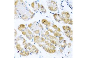 Immunohistochemistry of paraffin-embedded human stomach using RPS2 antibody. (RPS2 抗体  (AA 1-293))