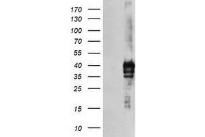 HEK293T cells were transfected with the pCMV6-ENTRY control (Left lane) or pCMV6-ENTRY SDS (Right lane) cDNA for 48 hrs and lysed. (serine Dehydratase 抗体)