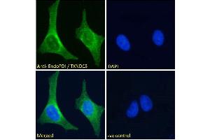 ABIN185279 Immunofluorescence analysis of paraformaldehyde fixed U2OS cells, permeabilized with 0.