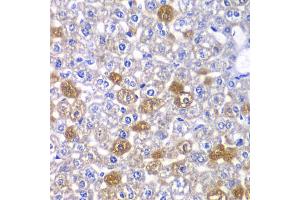 Immunohistochemistry of paraffin-embedded mouse liver using MYO1C antibody (ABIN5974171) at dilution of 1/100 (40x lens). (Myosin IC 抗体)