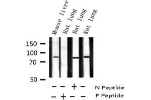 Western Blotting (WB) image for anti-Signal Transducer and Activator of Transcription 5A (STAT5A) (pSer780) antibody (ABIN6256423)