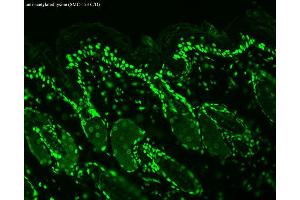Immunohistochemistry analysis using Mouse Anti-Acetylated Lysine Monoclonal Antibody, Clone 7F8 . (Lysine (lys) (acetylated) 抗体 (FITC))