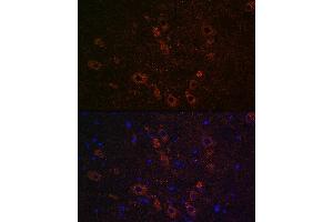Immunofluorescence analysis of rat brain using SLC5 Rabbit pAb (ABIN7267643) at dilution of 1:100 (40x lens). (ChT 抗体  (AA 421-580))
