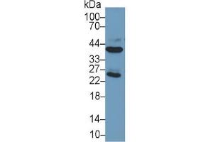 Mouse Capture antibody from the kit in WB with Positive Control: Sample Human Liver lysate;. (ARG ELISA 试剂盒)