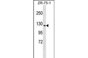 ERN1 Antibody (C-term) (ABIN1537620 and ABIN2849317) western blot analysis in ZR-75-1 cell line lysates (35 μg/lane). (ERN1 抗体  (C-Term))