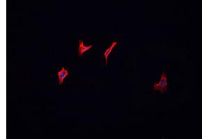 ABIN6266695 staining MCF-7 cells by IF/ICC. (HGS 抗体  (Internal Region))