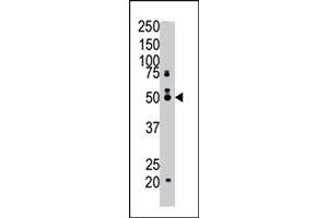 The FDFT1 polyclonal antibody  is used in Western blot to detect FDFT1 in mouse cerebellum tissue lysate . (FDFT1 抗体  (N-Term))