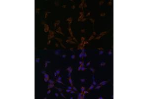 Immunofluorescence (IF) image for anti-Dynein, Light Chain, LC8-Type 2 (DYNLL2) (AA 1-89) antibody (ABIN6139893)