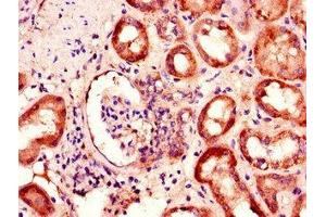 Immunohistochemistry of paraffin-embedded human kidney tissue using ABIN7145231 at dilution of 1:100 (BBS1 抗体  (AA 217-417))