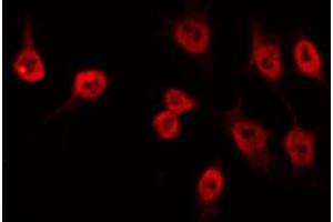 ABIN6274533 staining Hela by IF/ICC. (HMG20B 抗体  (N-Term))