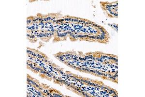 Immunohistochemistry of paraffin embedded mouse small intestine using AnnexinA13 (ABIN7073061) at dilution of 1:1500 (400x lens) (Annexin A13 抗体)