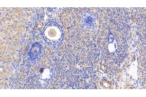 Detection of MYH11 in Rat Ovary Tissue using Polyclonal Antibody to Myosin Heavy Chain 11, Smooth Muscle (MYH11)