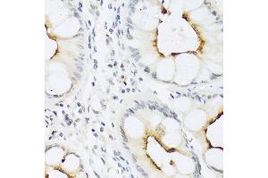 Immunohistochemistry of paraffin-embedded human colon using CCL22 antibody at dilution of 1:100 (40x lens). (CCL22 抗体)