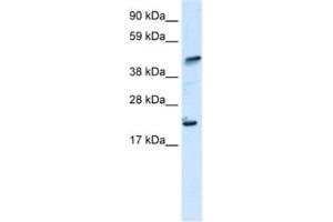 Western Blotting (WB) image for anti-IKAROS Family Zinc Finger 5 (Pegasus) (IKZF5) antibody (ABIN2460681)