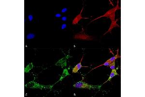 Immunocytochemistry (ICC) image for anti-Calcium Channel, Voltage-Dependent, gamma Subunit 2 (CACNG2) (AA 203-323) antibody (Biotin) (ABIN2483284)
