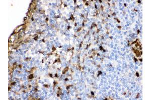 Immunohistochemistry (Paraffin-embedded Sections) (IHC (p)) image for anti-S100 Calcium Binding Protein A9 (S100A9) (AA 2-114) antibody (ABIN3043321) (S100A9 抗体  (AA 2-114))