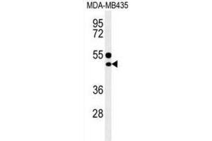 Western Blotting (WB) image for anti-CD1e (CD1e) antibody (ABIN3004387) (CD1e 抗体)