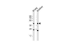 All lanes : Anti-Epcam Antibody (C-term) at 1:2000 dilution Lane 1: mouse lung lysates Lane 2: mouse kidney lysates Lysates/proteins at 20 μg per lane. (EpCAM 抗体  (C-Term))