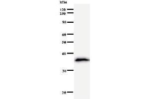 Western Blotting (WB) image for anti-Leucine Zipper, Down-Regulated in Cancer 1 (LDOC1) antibody (ABIN932190) (LDOC1 抗体)