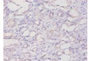 Immunohistochemistry of paraffin-embedded human kidney tissue using ABIN7152720 at dilution of 1:20 (FTL 抗体  (AA 2-175))