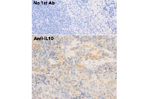 Immunohistochemistry (IHC) image for anti-Interleukin 10 (IL10) antibody (ABIN6254177) (IL-10 抗体)