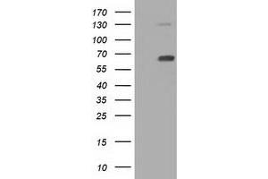 Western Blotting (WB) image for anti-Pyruvate Kinase, Liver and RBC (PKLR) antibody (ABIN1500245) (PKLR 抗体)