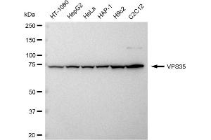 Western blotting analysis using VPS35 antibody (ABIN7800814). (Recombinant VPS35 抗体)