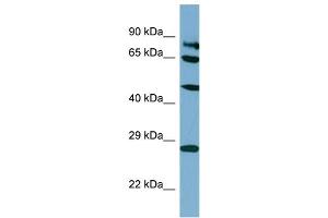 Host:  Rabbit  Target Name:  SV2B  Sample Type:  HT1080 Whole Cell lysates  Antibody Dilution:  1. (SV2B 抗体  (C-Term))