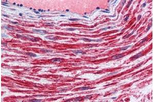 Anti-TFPI antibody IHC staining of human vessel.