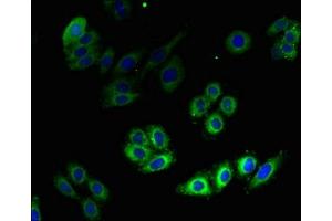Immunofluorescent analysis of HepG2 cells using ABIN7142292 at dilution of 1:100 and Alexa Fluor 488-congugated AffiniPure Goat Anti-Rabbit IgG(H+L) (HMGCR 抗体  (AA 588-887))