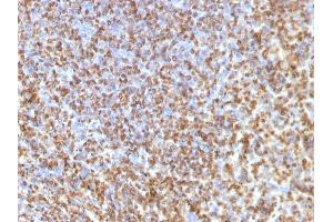 Formalin-fixed, paraffin-embedded human Spleen stained with Galectin-13 Monoclonal Antibody (PP13/1161).