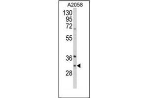 Western blot analysis of ING5 Antibody (Center) in A2058 cell line lysates (35ug/lane). (ING5 抗体  (Middle Region))