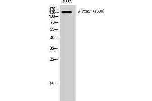 Western Blotting (WB) image for anti-PTK2B Protein tyrosine Kinase 2 beta (PTK2B) (pTyr580) antibody (ABIN3182496) (PTK2B 抗体  (pTyr580))