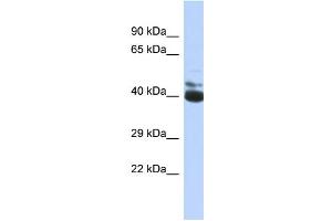 Western Blotting (WB) image for anti-FERM Domain Containing 3 (FRMD3) (C-Term) antibody (ABIN2774119) (FRMD3 抗体  (C-Term))
