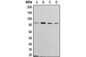 Western blot analysis of Cortactin expression in MCF7 (A), C6 (B), A431 (C), HeLa (D) whole cell lysates. (Cortactin 抗体  (C-Term))