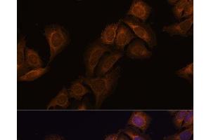 Immunofluorescence analysis of U-2 OS cells using ATXN2 Polyclonal Antibody at dilution of 1:100. (Ataxin 2 抗体)