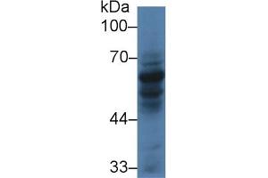 Detection of CARD9 in Human HL60 cell lysate using Polyclonal Antibody to Caspase Recruitment Domain Family, Member 9 (CARD9) (CARD9 抗体  (AA 26-283))