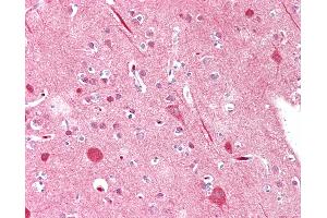 Anti-MYF5 / MYF 5 antibody IHC staining of human brain, cortex. (MYF5 抗体  (AA 7-36))