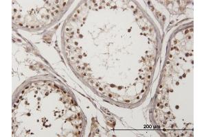 Immunoperoxidase of monoclonal antibody to CHEK2 on formalin-fixed paraffin-embedded human testis. (CHEK2 抗体  (AA 1-543))