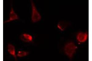 ABIN6267391 staining Hela by IF/ICC. (ATF2 抗体  (pThr55, pThr73))
