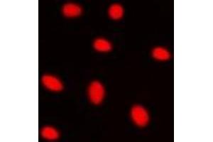 Immunofluorescent analysis of ZNF668 staining in HepG2 cells. (ZNF668 抗体)