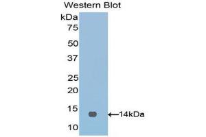 Western blot analysis of the recombinant protein. (VTCN1 抗体  (AA 34-147))