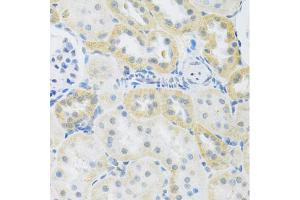 Immunohistochemistry of paraffin-embedded rat kidney using SLC39A7 antibody (ABIN5971725) at dilution of 1/100 (40x lens). (SLC39A7 抗体)