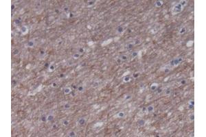 DAB staining on IHC-P; Samples: Human Cerebrum Tissue) (CKM 抗体)