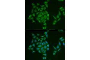 Immunofluorescence analysis of HeLa cell using AMPD3 antibody. (AMPD3 抗体)