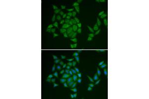 Immunofluorescence analysis of HeLa cell using AMPD3 antibody. (AMPD3 抗体)