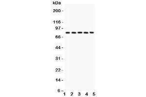 Western blot testing of Calpain antibody and Lane 1:  rat lung;  2: mouse lung;  3: human A549;  4: (h) COLO320;  5: (h) Jurkat. (Calpain 抗体  (Catalytic Subunit))